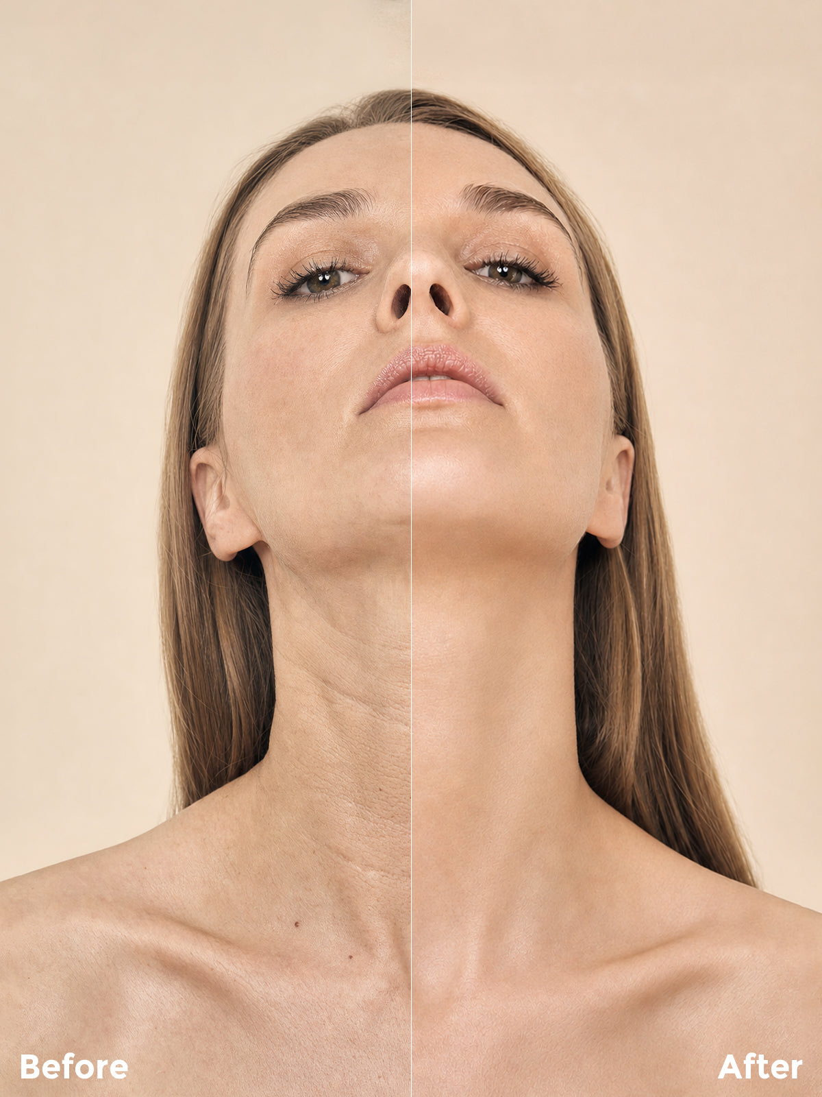 Wrinkle Reduction