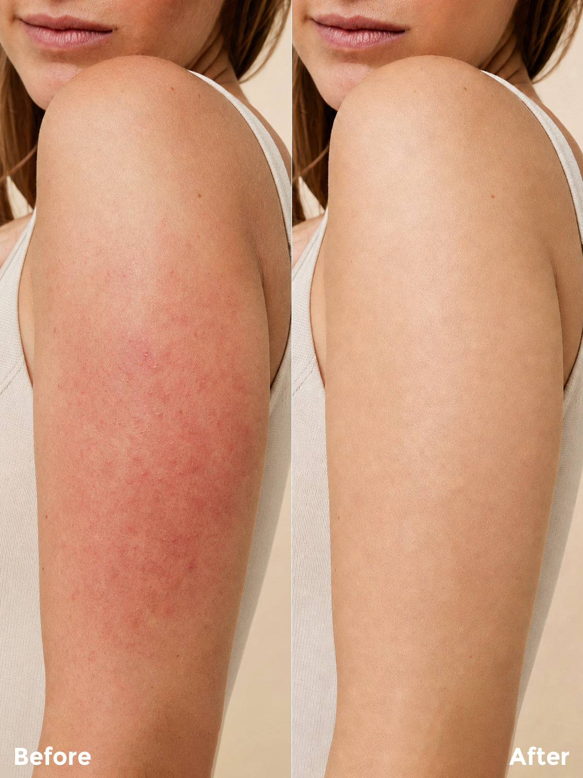 Inflammation & Soothing