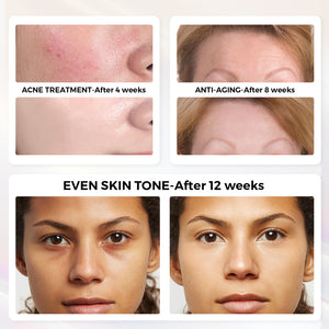 QuasarMD Contour Glow 3D Mask