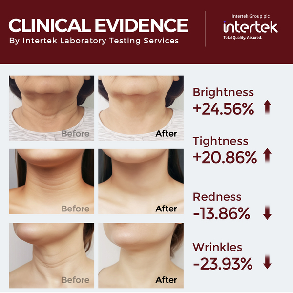 QuasarMD Neck & Décolleté Light Therapy Device